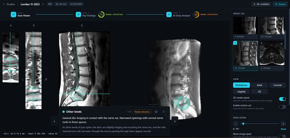 Read Your Scan product preview for startup listing on Aura++